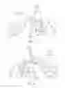 Fig. 12 - UNIVERSAL DOUBLE OFFSET SURGICAL INSTRUMENT