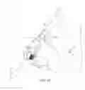 Fig. 13 - UNIVERSAL DOUBLE OFFSET SURGICAL INSTRUMENT