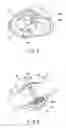 Fig. 05 - Joint surgical treatment