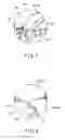 Fig. 06 - Joint surgical treatment