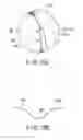 Fig. 08 - Joint surgical treatment