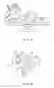 Fig. 17 - Joint surgical treatment