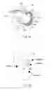 Fig. 18 - Joint surgical treatment