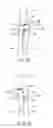 Fig. 26 - Joint surgical treatment