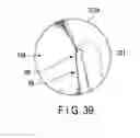 Fig. 29 - Joint surgical treatment