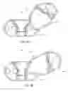 Fig. 09 - Rasp tool