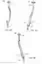 Fig. 30 - Rasp tool