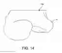 Fig. 13 - Orthopedic surgical guide