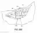 Fig. 22 - Orthopedic surgical guide