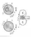 Fig. 03 - Occlusion bypassing apparatus with a re-entry needle and a distal stabilization balloon