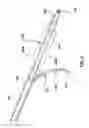 Fig. 04 - Occlusion bypassing apparatus with a re-entry needle and a distal stabilization balloon