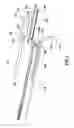 Fig. 05 - Occlusion bypassing apparatus with a re-entry needle and a distal stabilization balloon