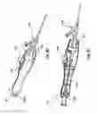 Fig. 15 - Occlusion bypassing apparatus with a re-entry needle and a distal stabilization balloon