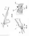 Fig. 16 - Occlusion bypassing apparatus with a re-entry needle and a distal stabilization balloon