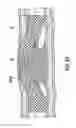 Fig. 27 - Occlusion bypassing apparatus with a re-entry needle and a distal stabilization balloon