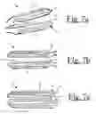 Fig. 06 - Electrosurgical forceps with resilient jaws