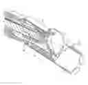 Fig. 01 - Tissue-removing catheter and tissue-removing element with depth stop