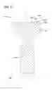 Fig. 06 - Tissue-removing catheter and tissue-removing element with depth stop