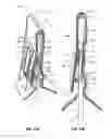 Fig. 19 - Scalpel blade remover