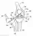 Fig. 01 - Joint surgical treatment
