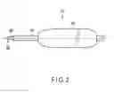 Fig. 03 - Joint surgical treatment