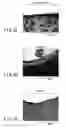 Fig. 07 - Joint surgical treatment