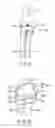 Fig. 08 - Joint surgical treatment