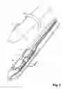 Fig. 02 - Transcatheter device for the ablation of calcified tissue at the flaps of an aortic valve