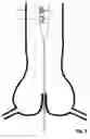 Fig. 05 - Transcatheter device for the ablation of calcified tissue at the flaps of an aortic valve