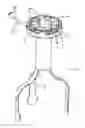 Fig. 03 - Access system for endoscopic operations