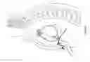 Fig. 02 - Interventional medical systems and methods for delivering a medical electrical lead to an epicardial implant site