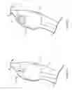 Fig. 07 - Interventional medical systems and methods for delivering a medical electrical lead to an epicardial implant site
