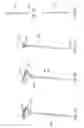Fig. 12 - Spinal stabilization systems with quick-connect sleeve assemblies for use in surgical procedures