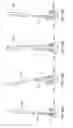 Fig. 41 - Spinal stabilization systems with quick-connect sleeve assemblies for use in surgical procedures