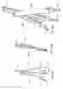 Fig. 50 - Spinal stabilization systems with quick-connect sleeve assemblies for use in surgical procedures