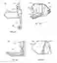Fig. 06 - Interspinous process spacing device
