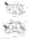 Fig. 12 - Interspinous process spacing device