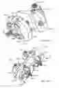 Fig. 20 - Interspinous process spacing device