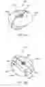 Fig. 22 - Interspinous process spacing device