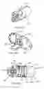Fig. 24 - Interspinous process spacing device