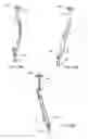 Fig. 30 - Interspinous process spacing device