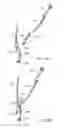 Fig. 31 - Interspinous process spacing device