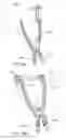 Fig. 32 - Interspinous process spacing device
