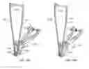 Fig. 37 - Interspinous process spacing device