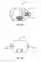 Fig. 41 - Interspinous process spacing device
