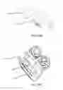 Fig. 44 - Interspinous process spacing device