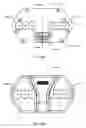 Fig. 47 - Interspinous process spacing device