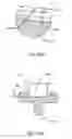 Fig. 49 - Interspinous process spacing device