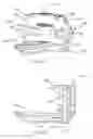 Fig. 50 - Interspinous process spacing device