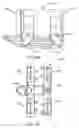 Fig. 53 - Interspinous process spacing device